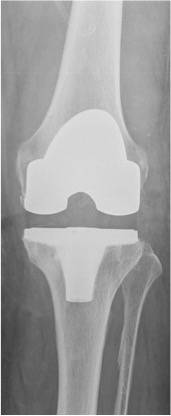 Das Röntgenbild zeigt eine...