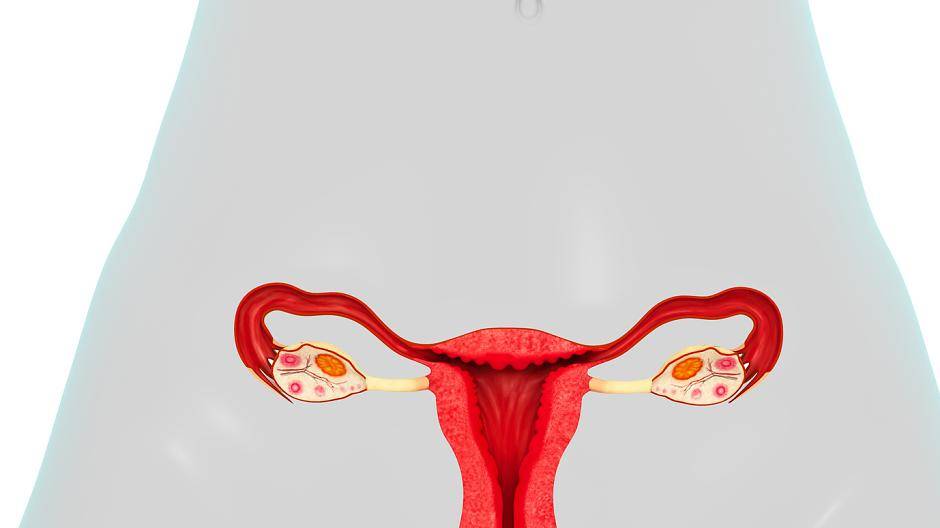 Selbst ein Organ wie die Gebärmutter kann im MIC-Zentrum Bergisches Land...